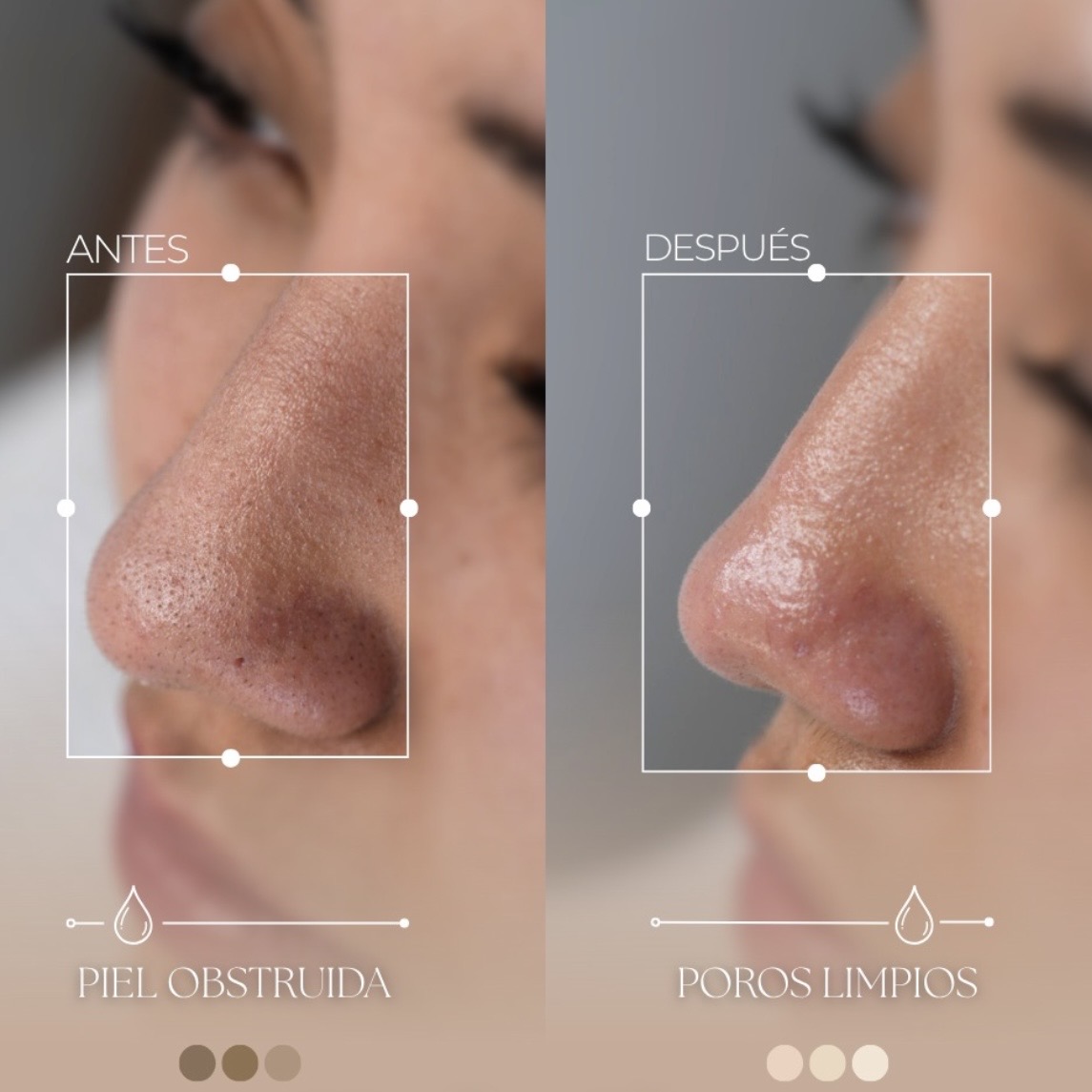 Limpieza facial profunda antes y despues