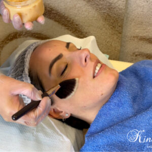 Limpieza facial profunda antes y despues