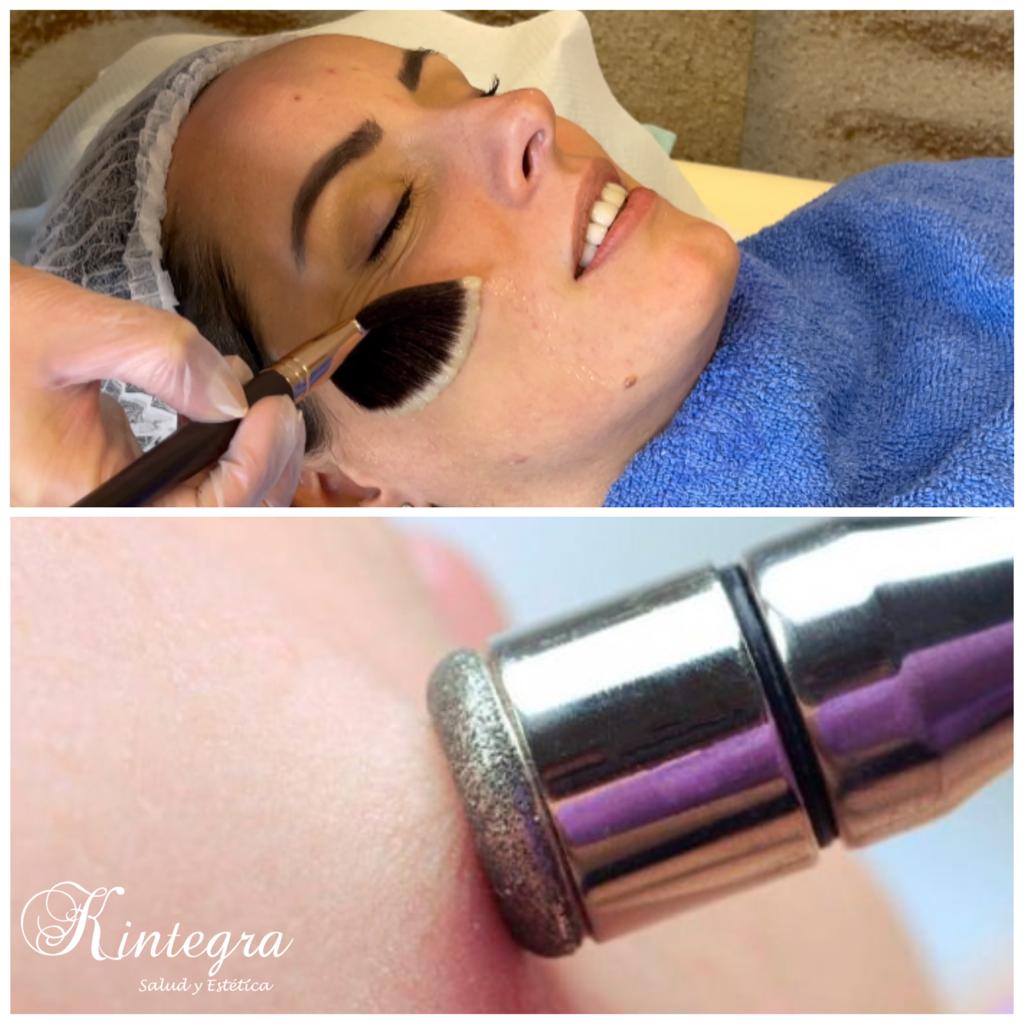 Limpieza facial profunda antes y despues