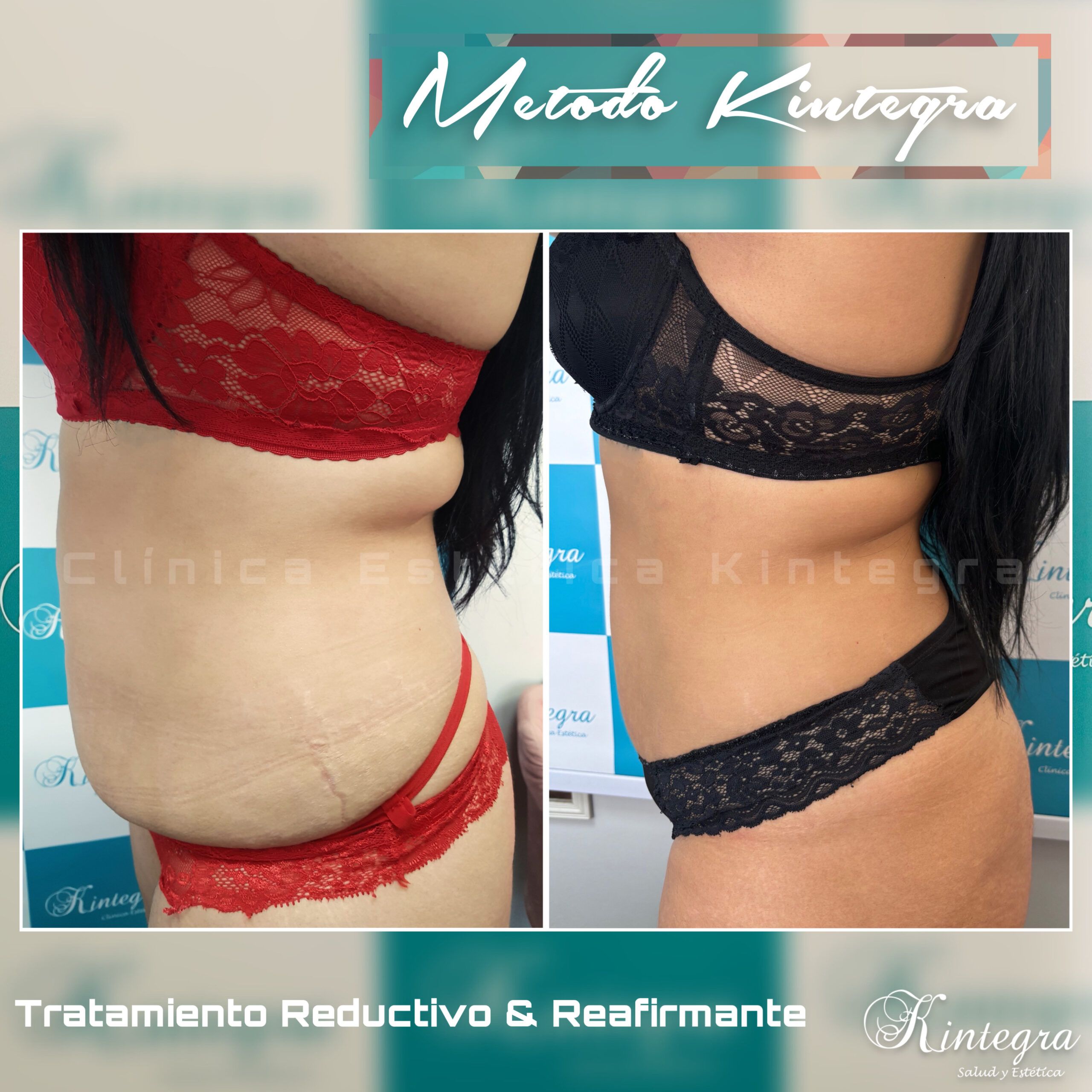 Tratamiento Reductivo Combinado (7 sesiones) - Imagen 17