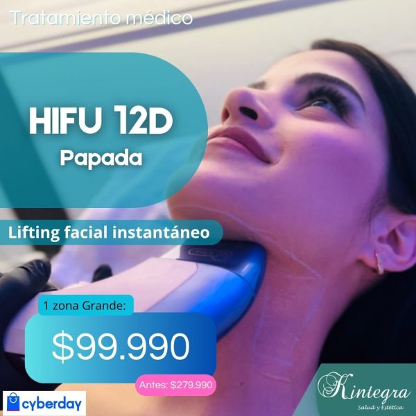 HIFU 12D - Lifting de Papada Sin Cirugía