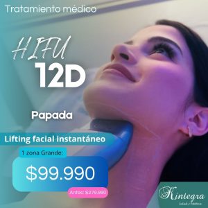 HIFU 12D - Lifting de Papada Sin Cirugía