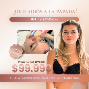 HIFU 12D - Lifting de Papada Sin Cirugía CYBER