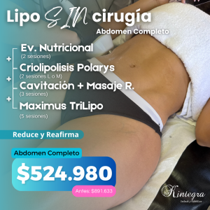 Lipo sin cirugía Abdomen completo