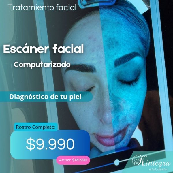 Evaluación de Escaner Facial Computarizado