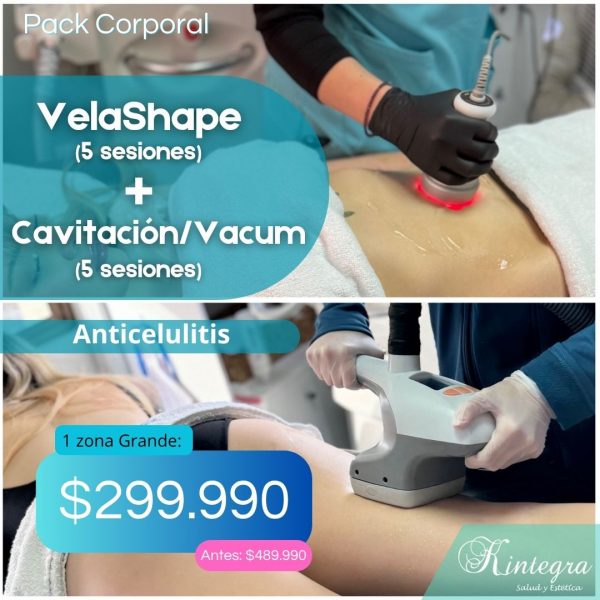 Anticelulitis: Velashape + Cavitación/Vacum