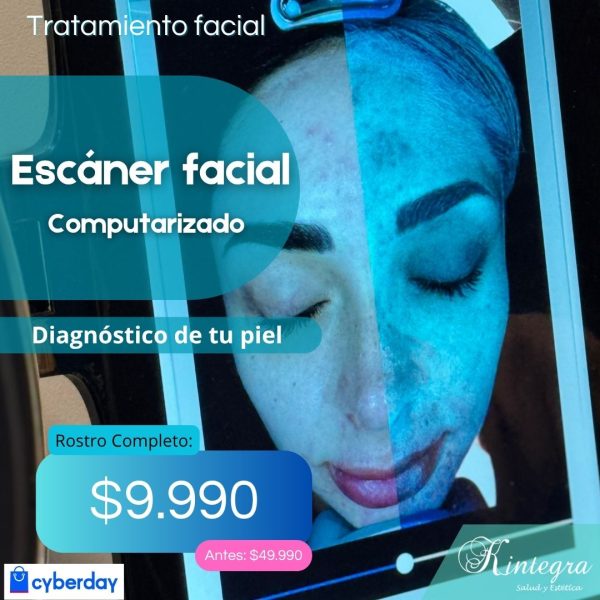 Evaluación de Escaner Facial Computarizado