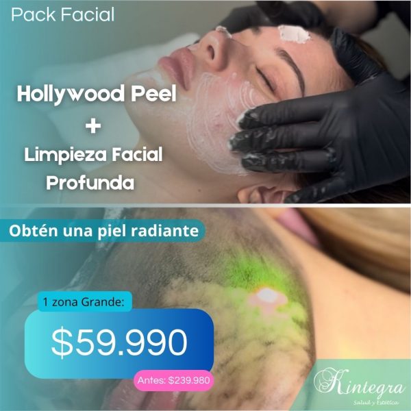 Hollywood Peel + Limpieza Facial Profunda