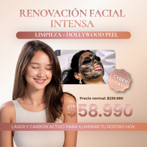 Hollywood Peel + Limpieza Facial CYBER
