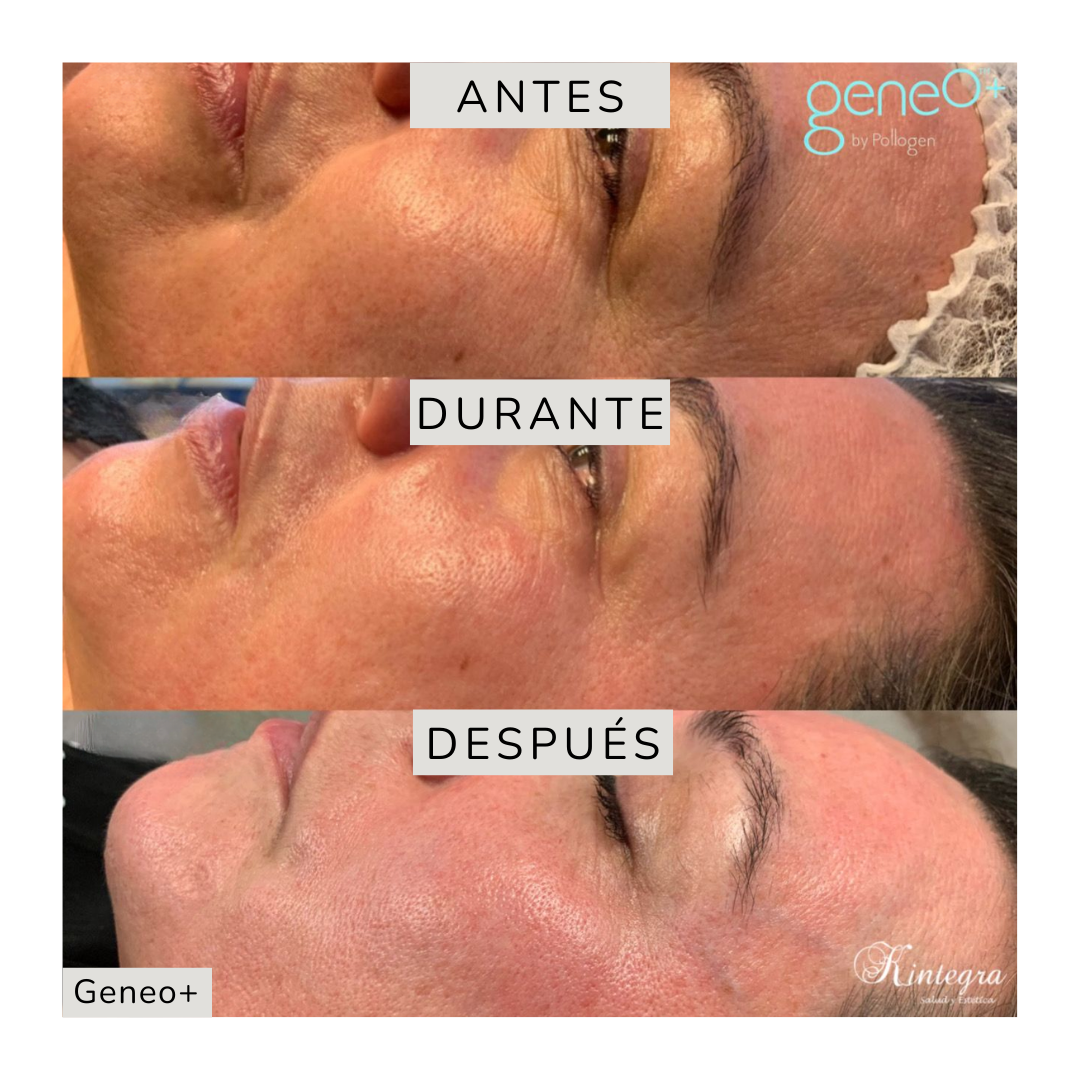 Tratamientos Corporales (10)