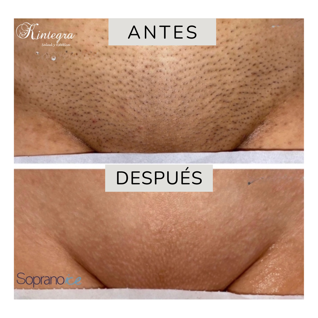 Tratamientos Corporales (5)