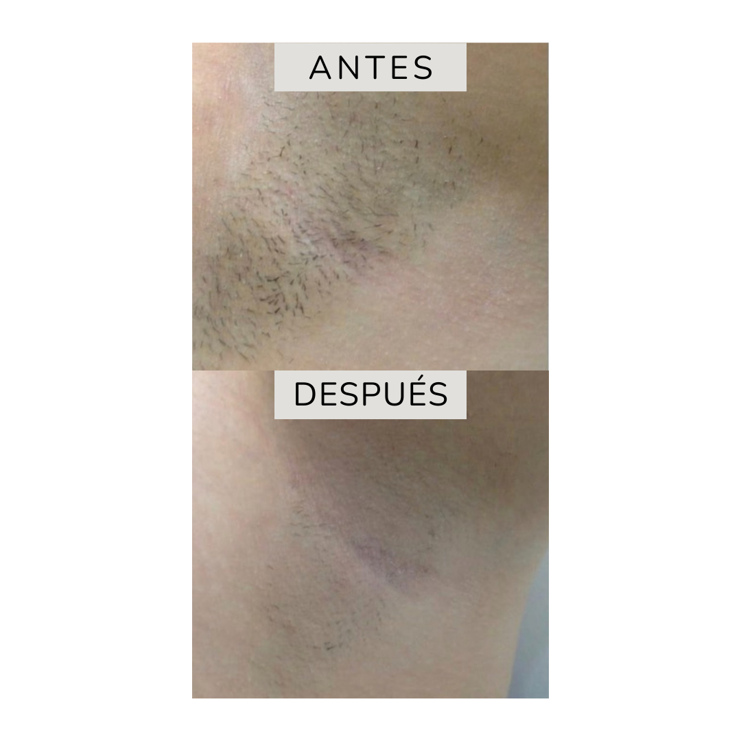 Tratamientos Corporales (6)