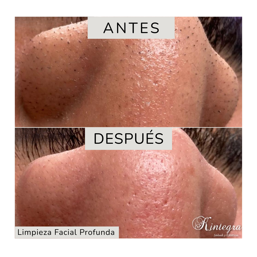 Tratamientos Corporales (9)