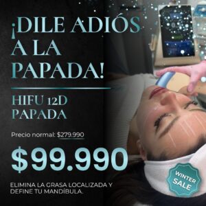HIFU 12D - Lifting de Papada Sin Cirugía