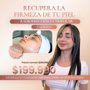 Reafirma y Rejuvenece: Radiofrecuencia Tripolar Facial CYBER