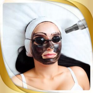 HOLLYWOOD PEEL